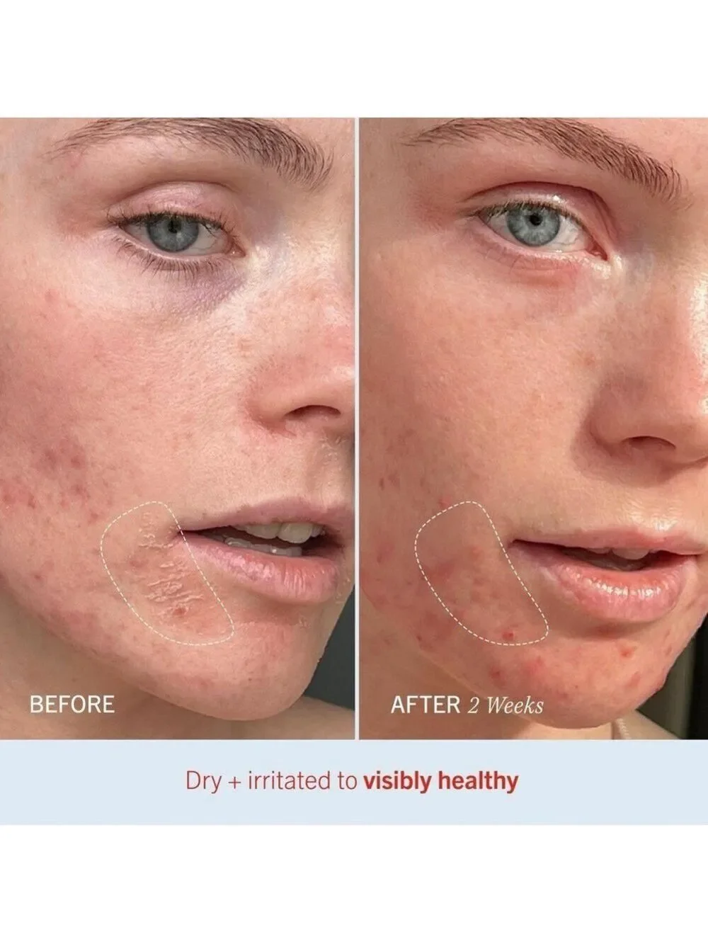 FAB Ultra Repair Cream | NEW | First Aid Beauty | Full Size | Colloidal Oatmeal